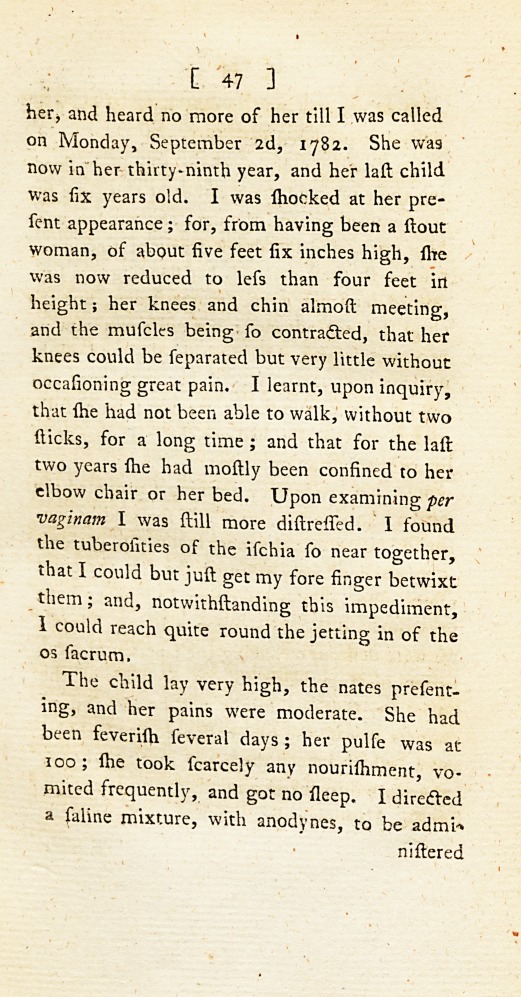 Case of a Woman Who Underwent the Section of the Symphysis Pubis.