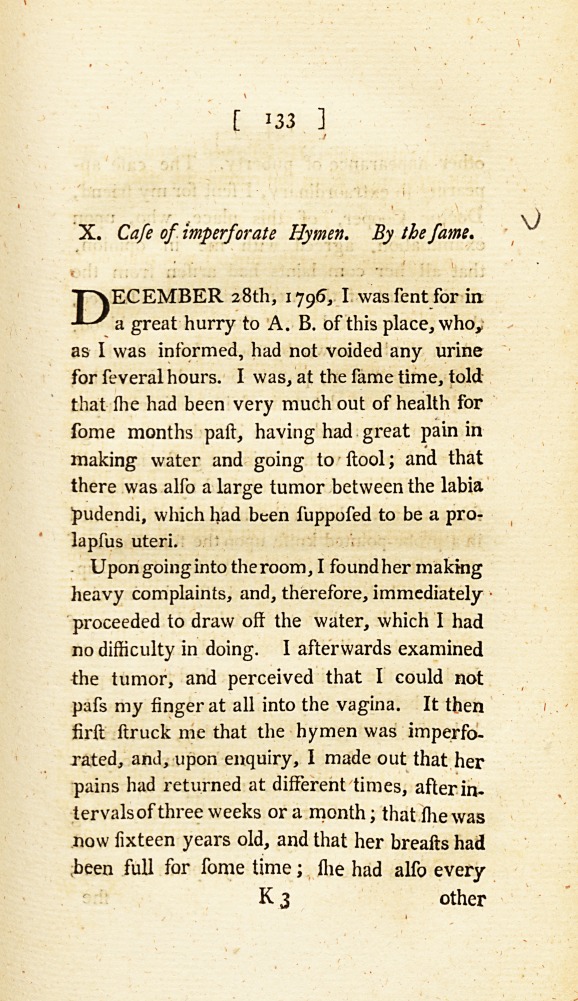 Case of Imperforate Hymen.