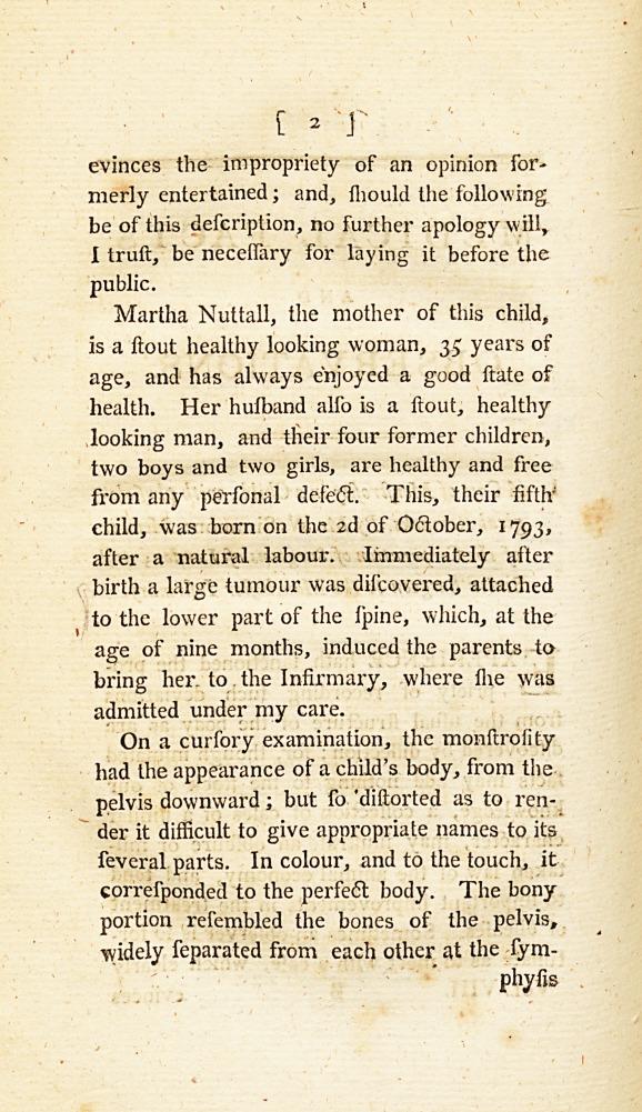 A Case of Monstrosity in a Child; with Physiological Remarks.