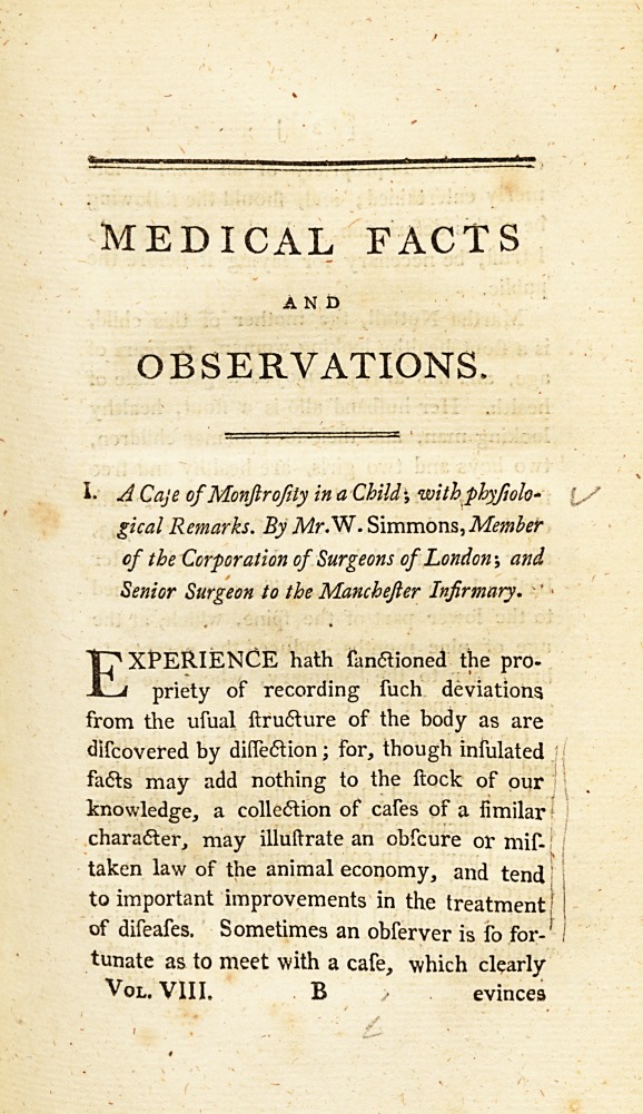 A Case of Monstrosity in a Child; with Physiological Remarks.