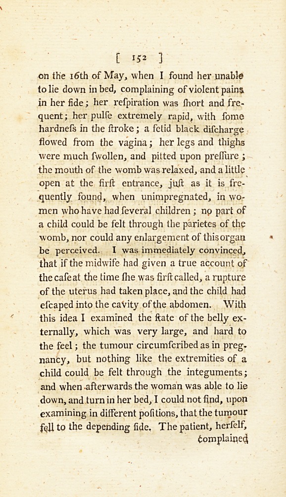 An Account of a Ruptured Uterus.