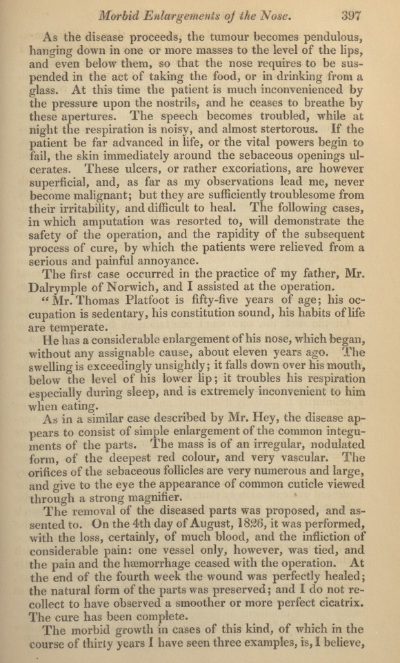 On the Removal of Morbid Enlargements of the Integuments of the Nose.