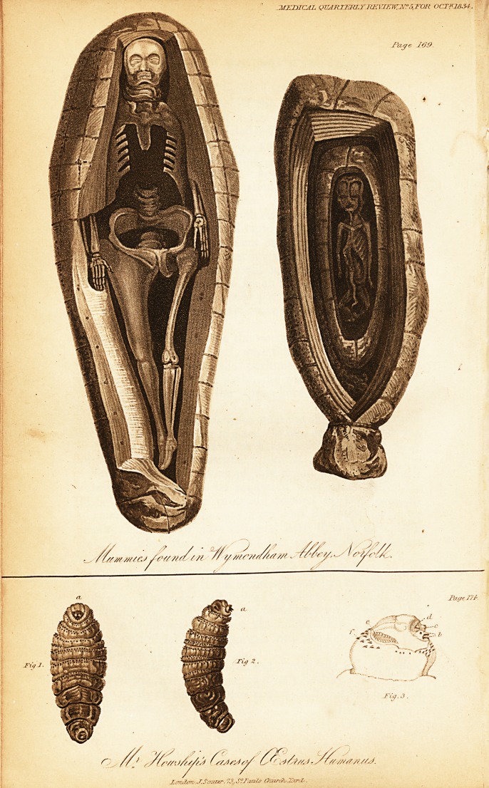 An Account of the Examination of Two Bodies, Found in the Vaults of the Ruins of Wymondham Abbey, in Norfolk.