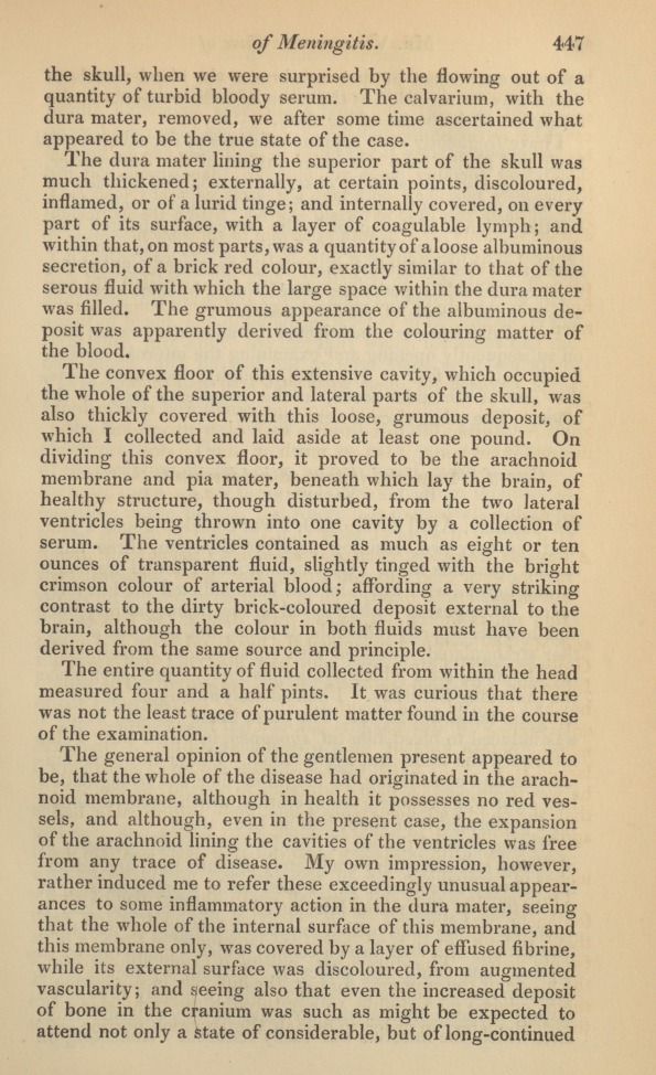 A Case, in Which a Collection of Fluid and Coagulable Matter, to the Amount of Several Pints, Took Place between the Membranes of the Brain.