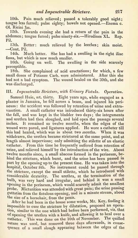 Mr. Key's Cases of Femoral Hernia and Impenetrable Stricture.