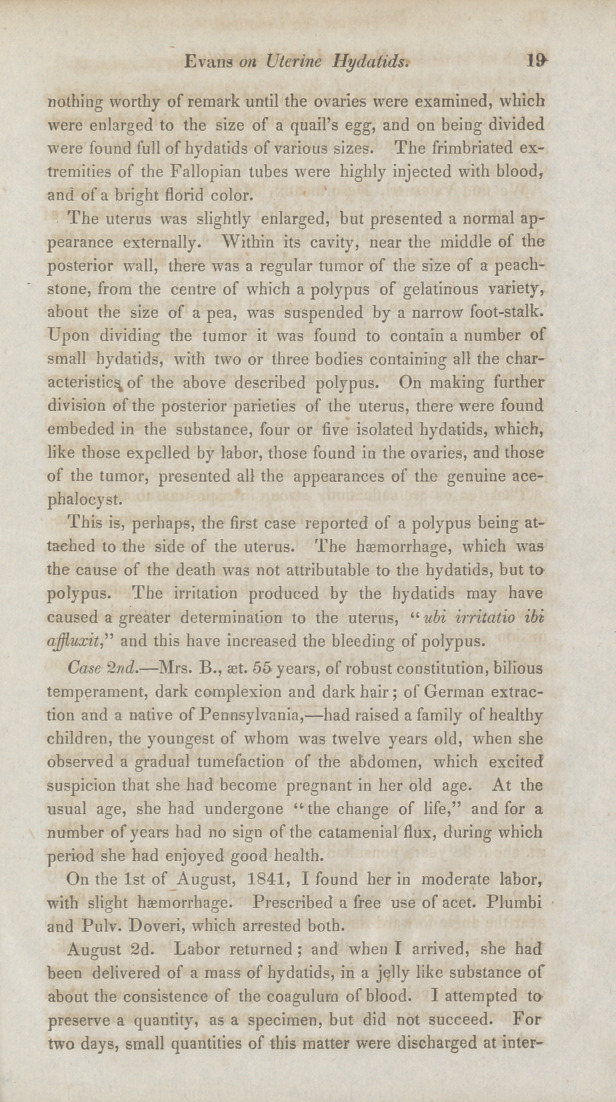 Two Cases Uterine Hydatids.