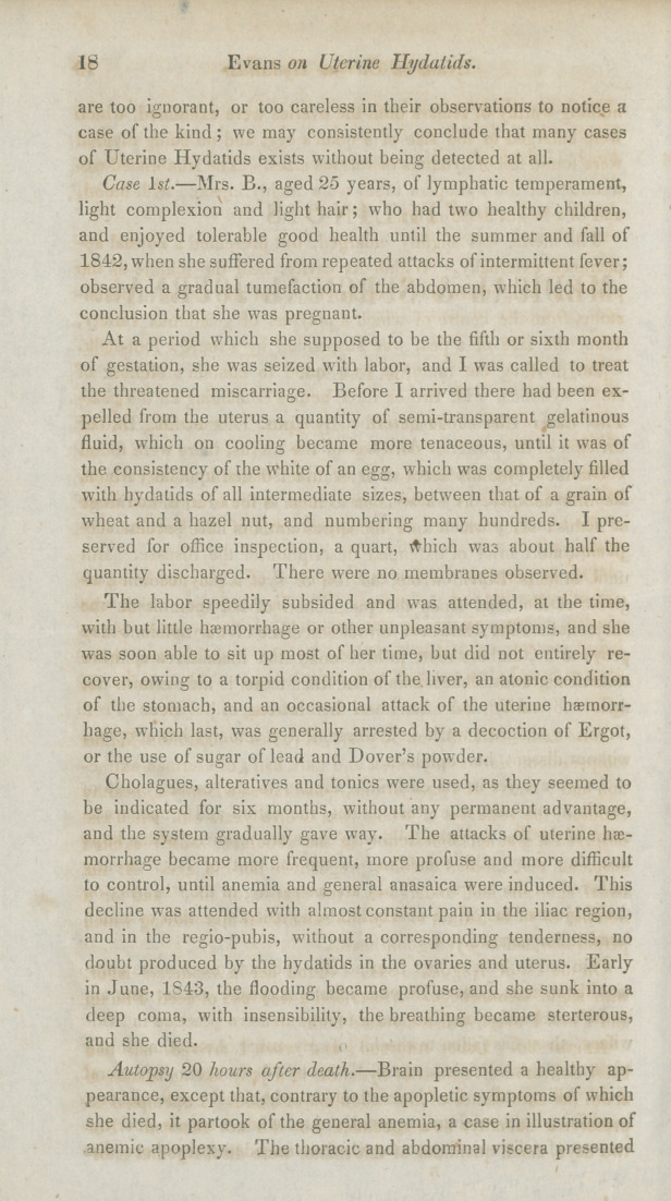 Two Cases Uterine Hydatids.