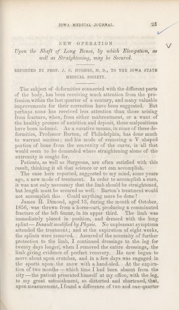 New Operation upon the Shaft of Long Bones, by Which Elongation as Well as Straightening, May Be Secured.