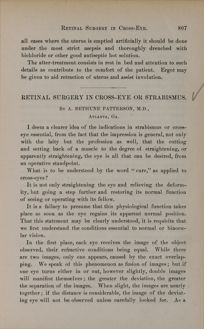 Retinal Surgery in Cross-eye or Strabismus.