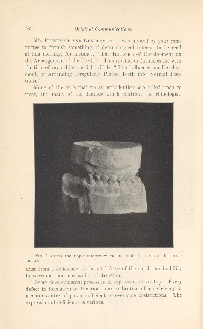 The Influence, on Development, of Arranging Irregularly Placed Teeth into Normal Positions.