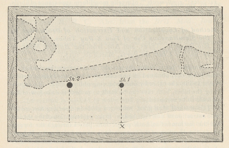 Method of Localization and Extraction of Projectiles by the Simultaneous Use of Two X-Ray Tubes.