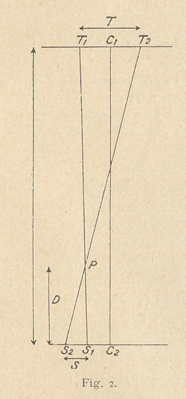 A Simple Method of X-ray Localization.