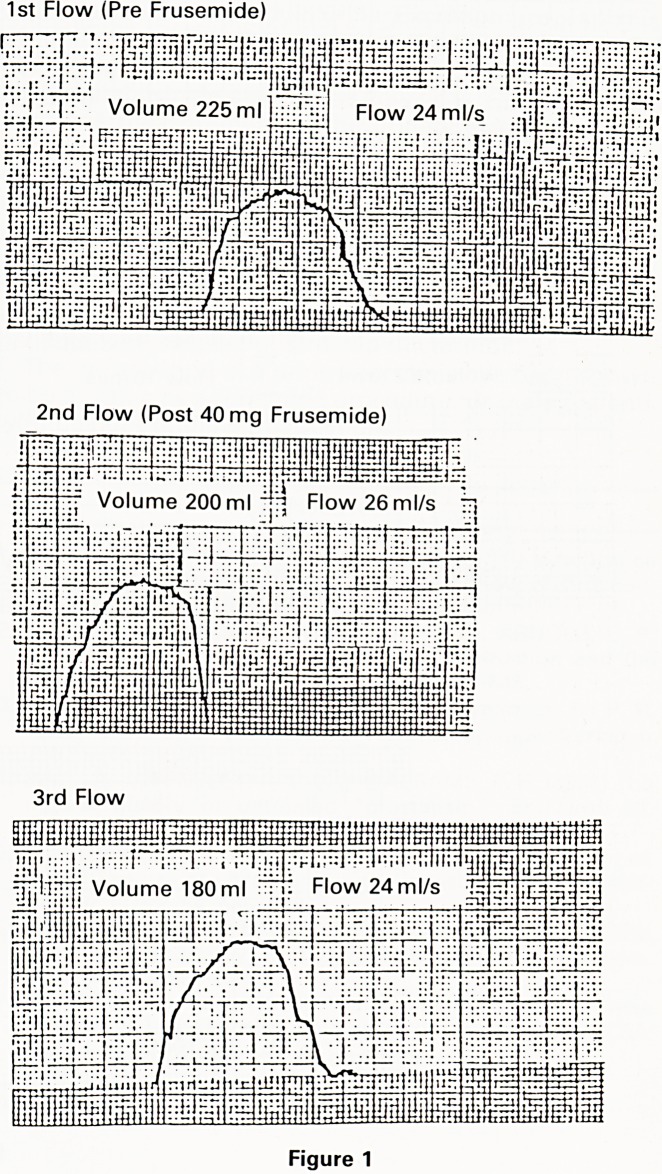 A urine flow clinic.