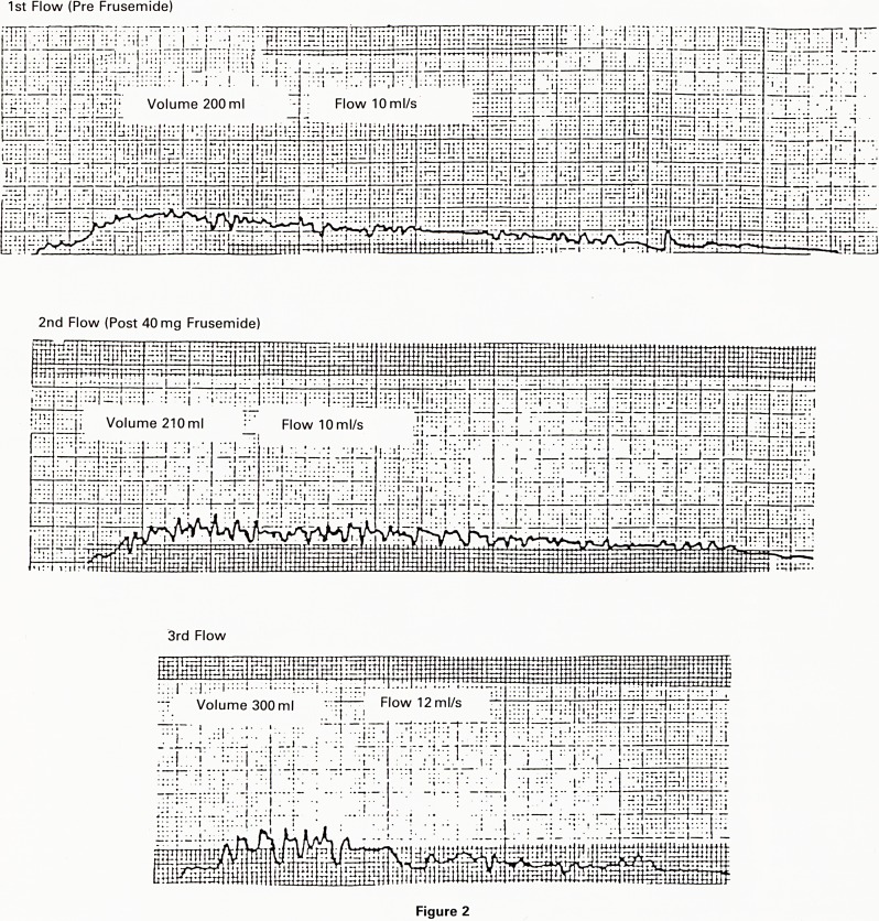 A urine flow clinic.