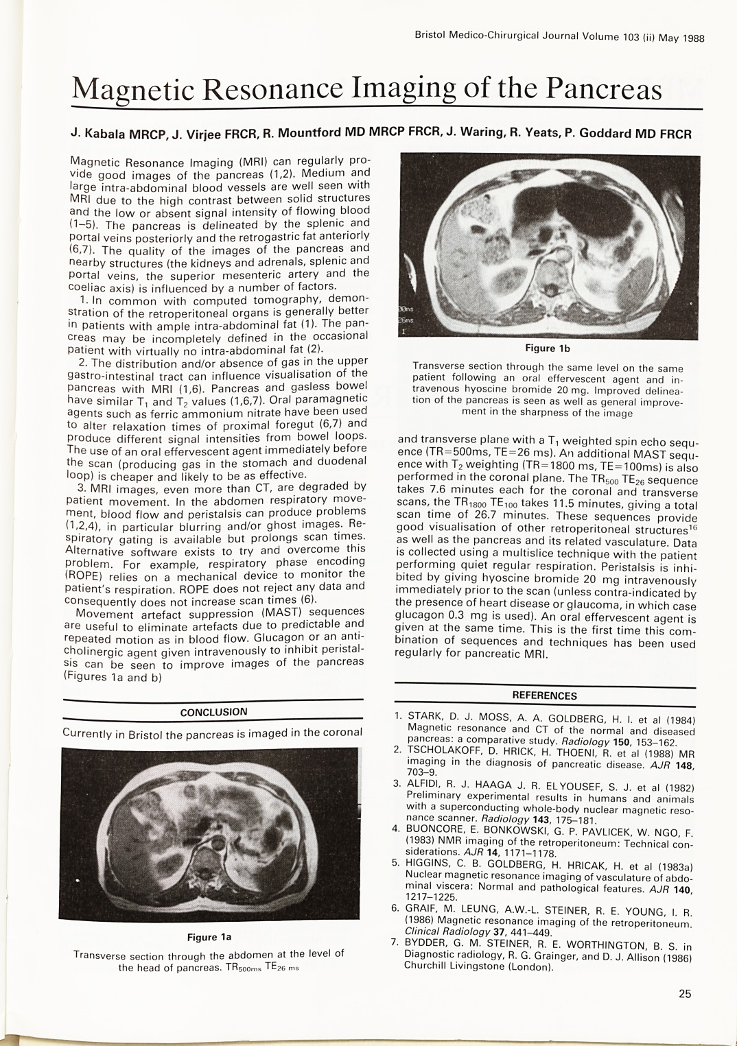 Magnetic resonance imaging of the pancreas.