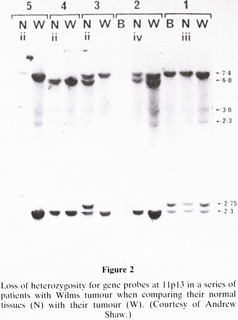 Mutation, malformation and malignancy. The 1987 Long Fox lecture.