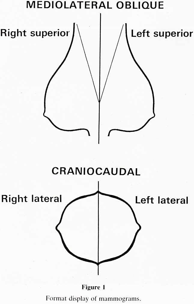 Practical aspects of mammography.