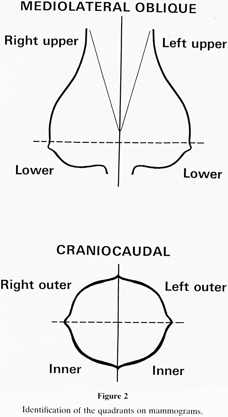 Practical aspects of mammography.