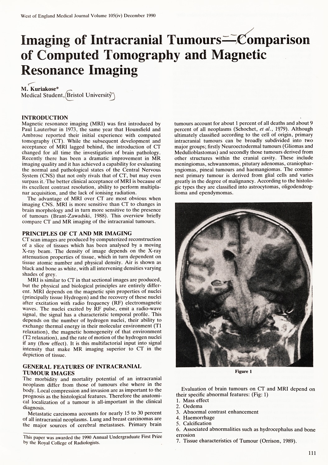 Imaging of intracranial tumours--comparison of computed tomography and magnetic resonance imaging.