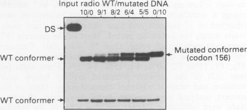 p53 immunohistochemical analysis in breast cancer with four monoclonal antibodies: comparison of staining and PCR-SSCP results