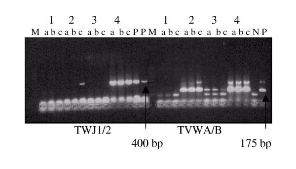 Evaluation of a polymerase chain reaction assay for the diagnosis of bovine trypanosomiasis and epidemiological surveillance in Bolivia.