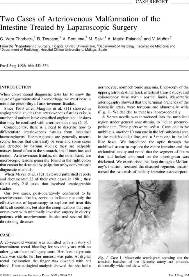 Two cases of arteriovenous malformation of the intestine treated by laparoscopic surgery