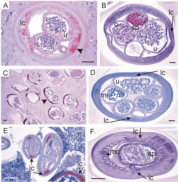 Obligatory symbiotic Wolbachia endobacteria are absent from Loa loa.