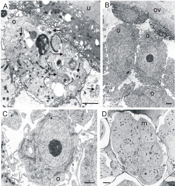 Obligatory symbiotic Wolbachia endobacteria are absent from Loa loa.