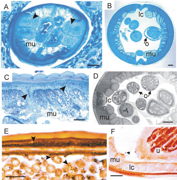 Obligatory symbiotic Wolbachia endobacteria are absent from Loa loa.