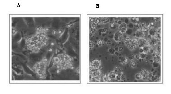 <i>In vivo</i> gene targeting of IL-3 into immature hematopoietic cells through CD117 receptor mediated antibody gene delivery.