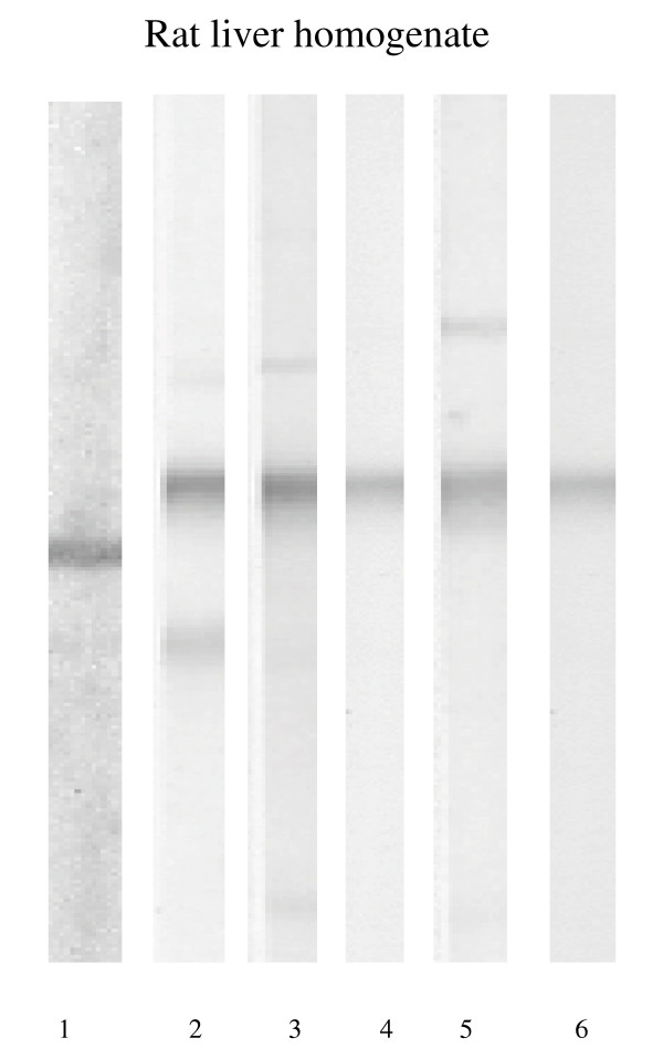 Antibodies to soluble liver antigen and alpha-enolase in patients with autoimmune hepatitis.