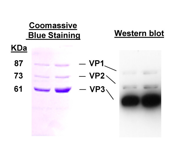 The recombinant adeno-associated virus vector (rAAV2)-mediated apolipoprotein B mRNA-specific hammerhead ribozyme: a self-complementary AAV2 vector improves the gene expression.