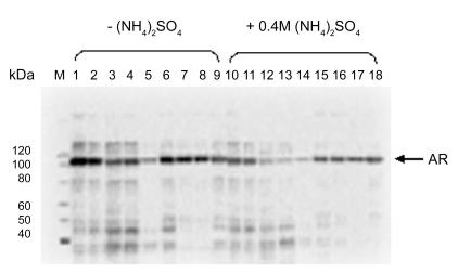 Single-step purification of full-length human androgen receptor.