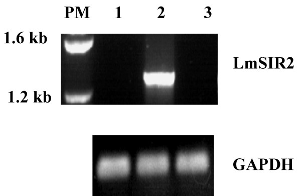 Experimental study of the function of the excreted/secreted Leishmania LmSIR2 protein by heterologous expression in eukaryotic cell line.