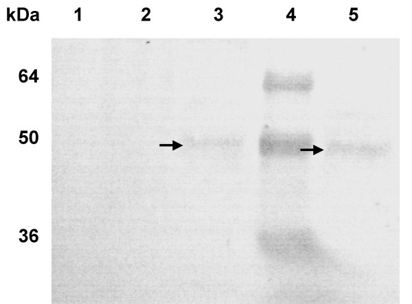 Experimental study of the function of the excreted/secreted Leishmania LmSIR2 protein by heterologous expression in eukaryotic cell line.