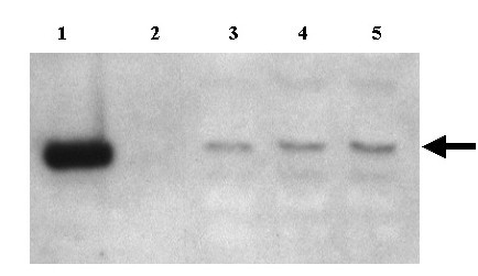 Human cytomegalovirus plasmid-based amplicon vector system for gene therapy.