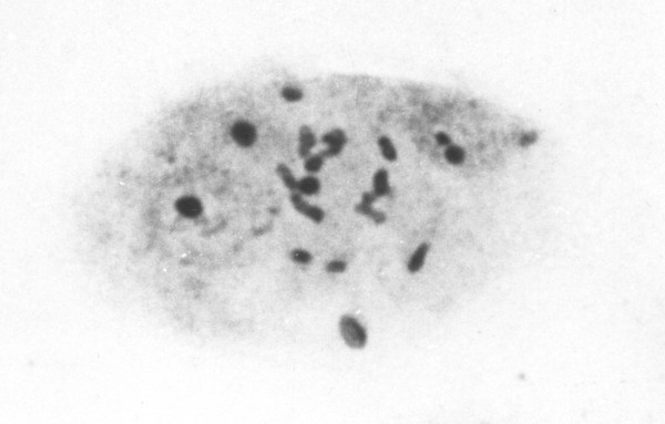 The chromosomes of the Filariae.