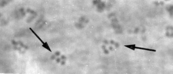 The chromosomes of the Filariae.