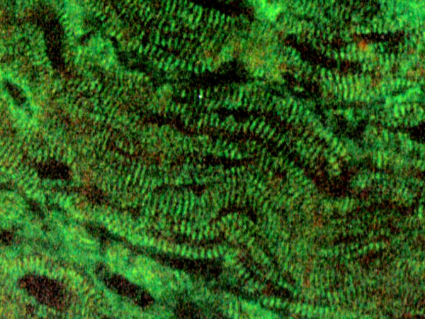 Autoantibody profiles in the sera of patients with Q fever: characterization of antigens by immunofluorescence, immunoblot and sequence analysis.