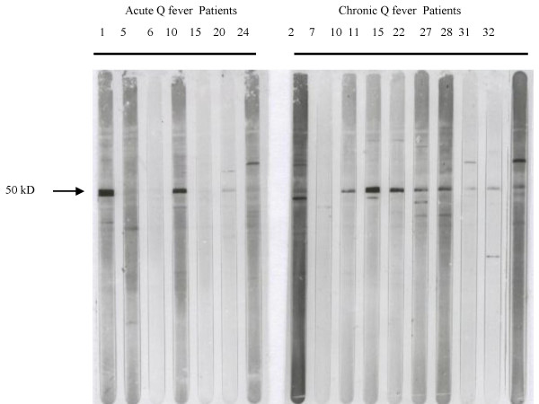 Autoantibody profiles in the sera of patients with Q fever: characterization of antigens by immunofluorescence, immunoblot and sequence analysis.