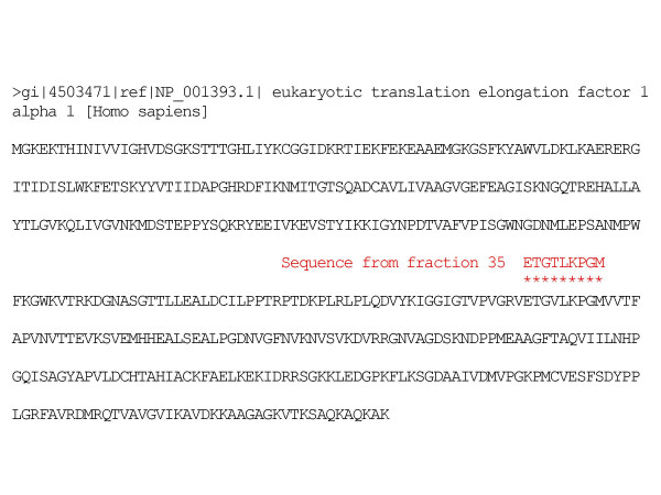 Autoantibody profiles in the sera of patients with Q fever: characterization of antigens by immunofluorescence, immunoblot and sequence analysis.