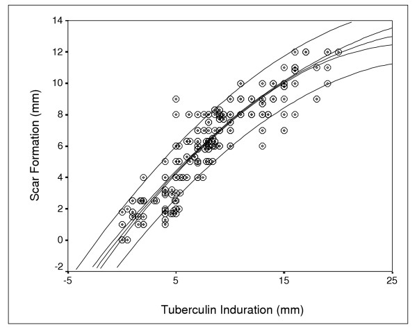 BCG vaccination at three different age groups: response and effectiveness.
