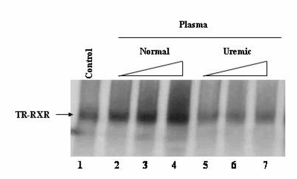 Thyroid hormone receptor binding to DNA and T3-dependent transcriptional activation are inhibited by uremic toxins.