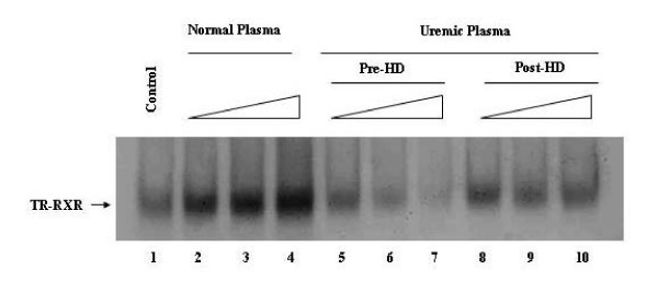 Thyroid hormone receptor binding to DNA and T3-dependent transcriptional activation are inhibited by uremic toxins.