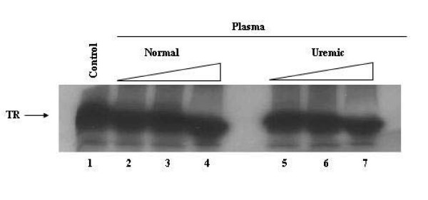 Thyroid hormone receptor binding to DNA and T3-dependent transcriptional activation are inhibited by uremic toxins.