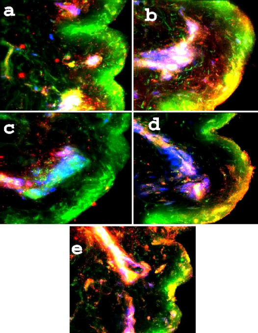 Immunofluorescence deconvolution microscopy and image reconstruction of human defensins in normal and burned skin.