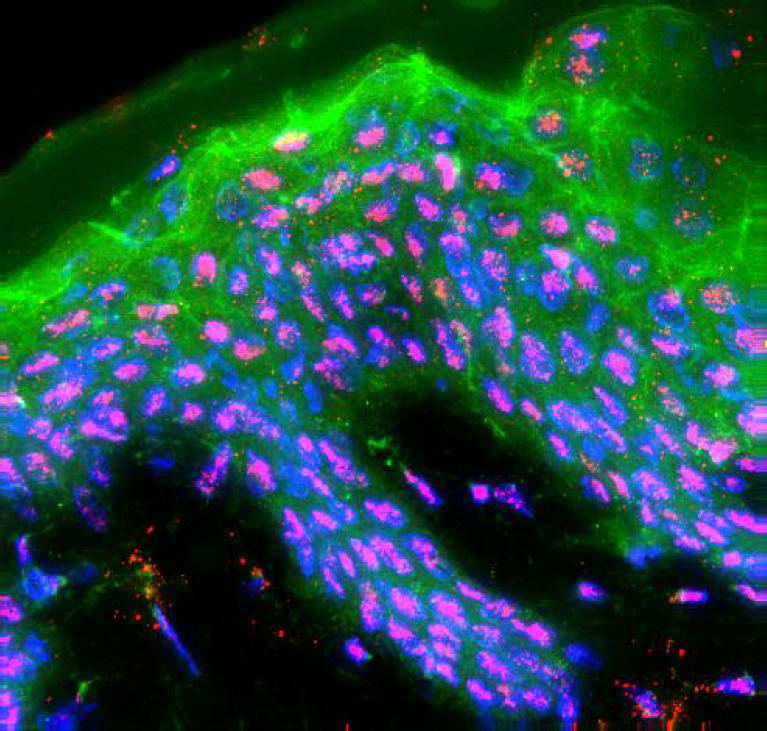 Immunofluorescence deconvolution microscopy and image reconstruction of human defensins in normal and burned skin.