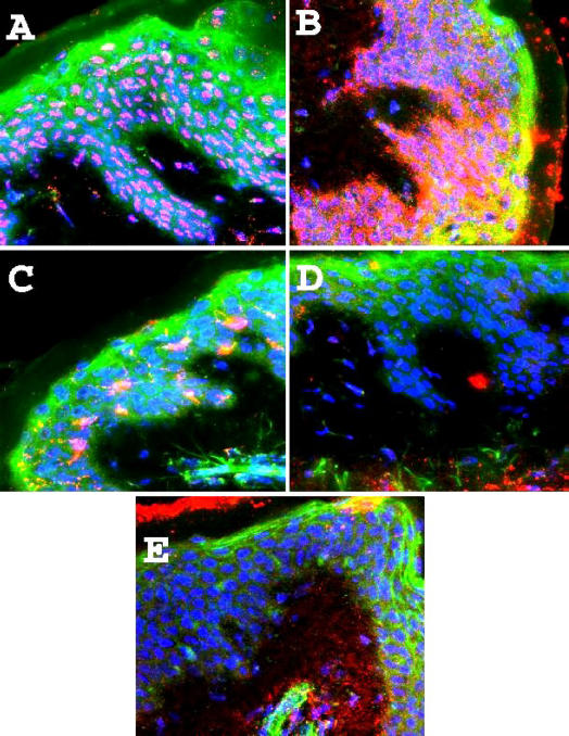 Immunofluorescence deconvolution microscopy and image reconstruction of human defensins in normal and burned skin.