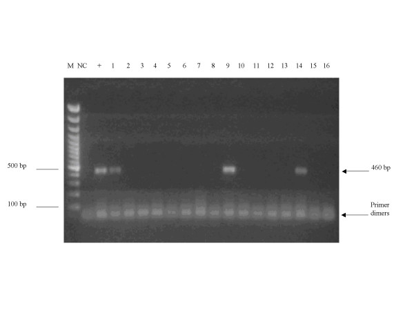 Detection of trypanosomes in small ruminants and pigs in western Kenya: important reservoirs in the epidemiology of sleeping sickness?