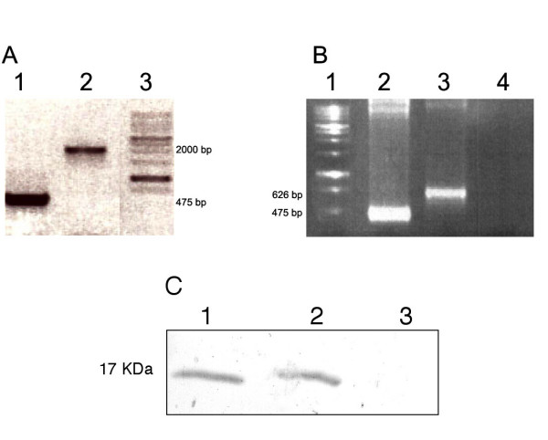 Studies on Acanthocheilonema viteae cystatin: genomic organization, promoter studies and expression in Caenorhabditis elegans.